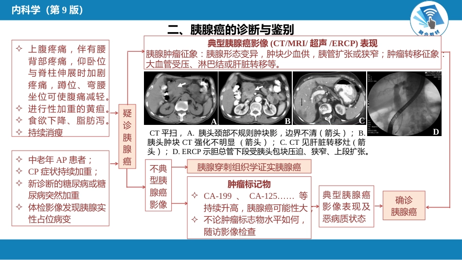 消化内科：胰腺癌_第4页