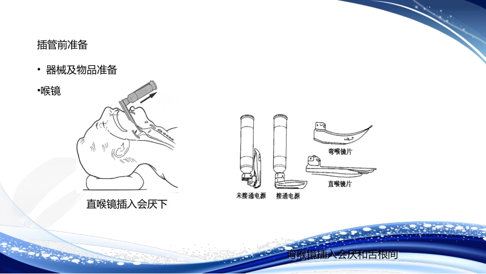 人工气道的建立气管插管术_第15页
