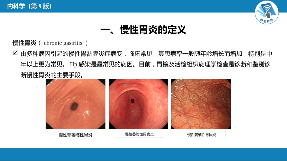 消化内科：胃炎_第11页
