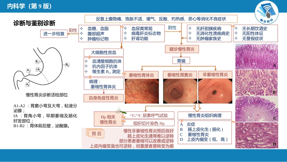 消化内科：胃炎_第13页