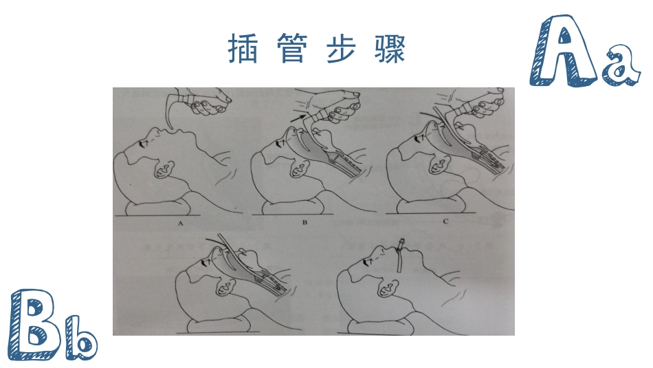 气管插管及气管切开的配合护理_第12页