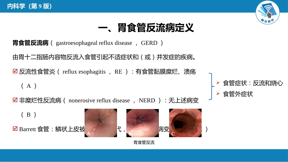 消化内科：胃食管反流病_第3页
