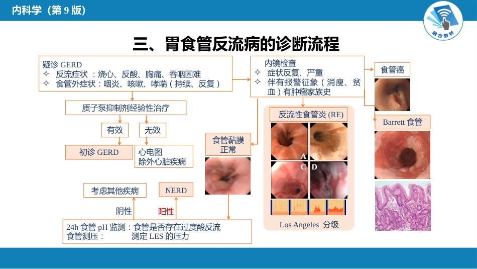 消化内科：胃食管反流病_第5页