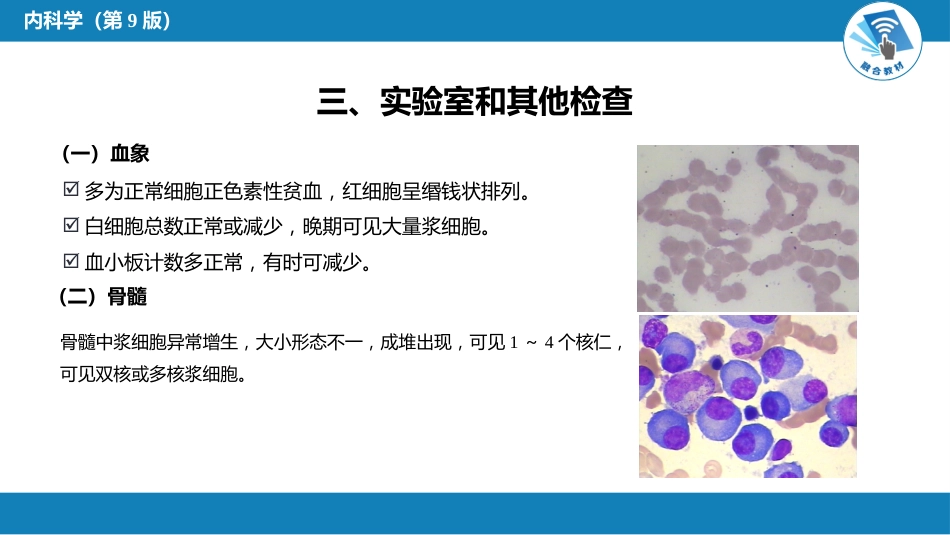 血液科：多发性骨髓瘤_第15页