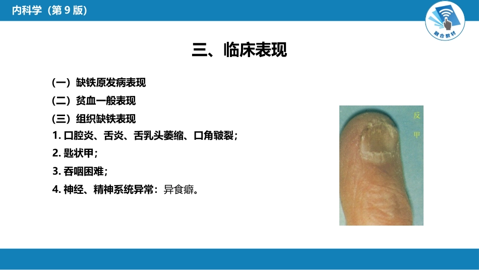 血液科：缺铁性贫血_第6页