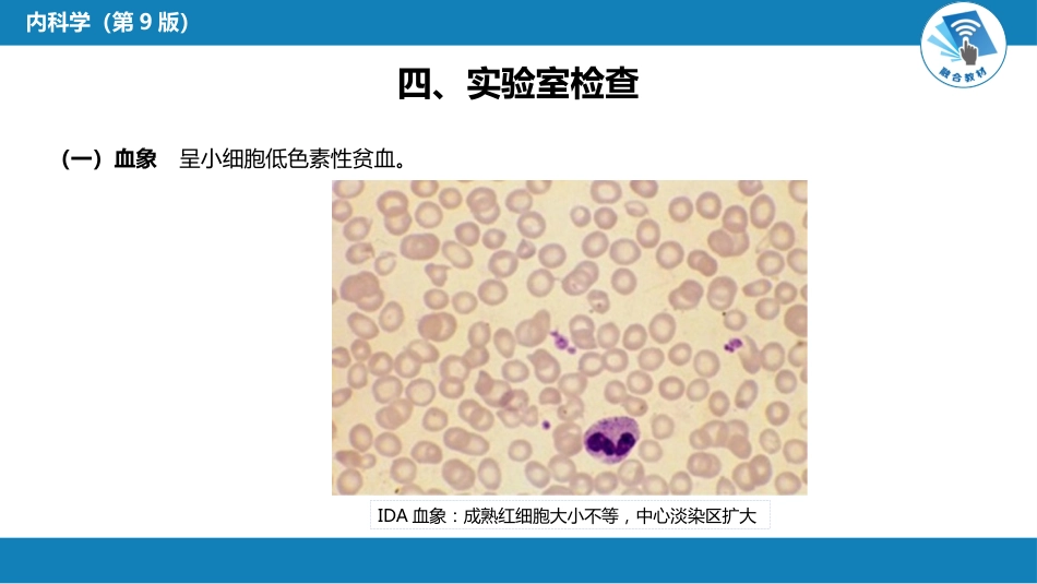 血液科：缺铁性贫血_第7页