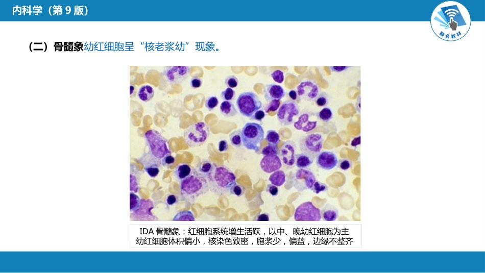 血液科：缺铁性贫血_第8页
