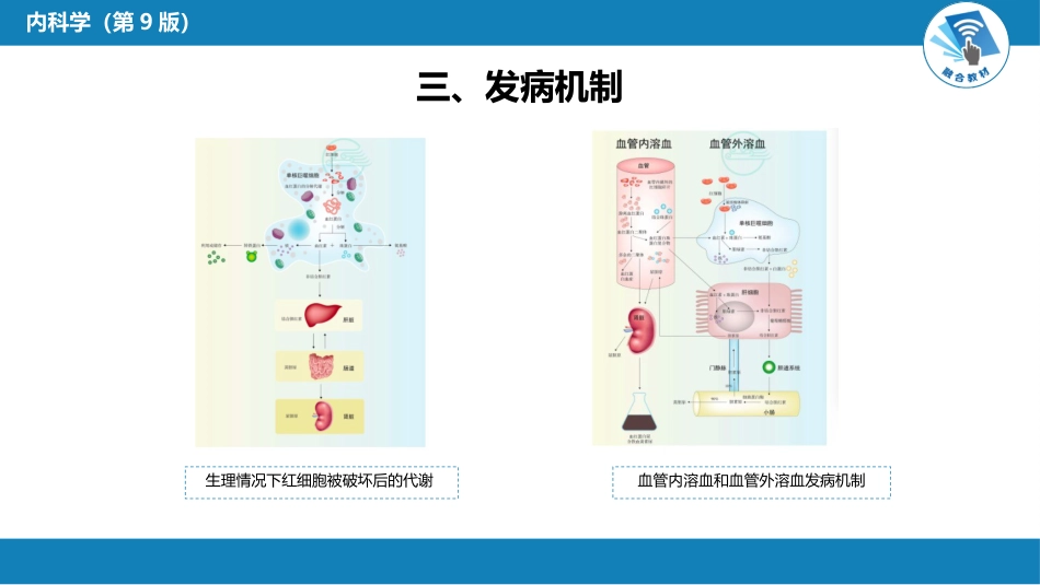 血液科：溶血性贫血（第1-4节）_第10页