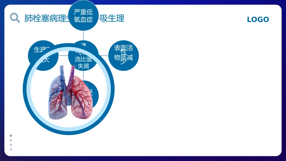 肺栓塞的护理查房1_第6页