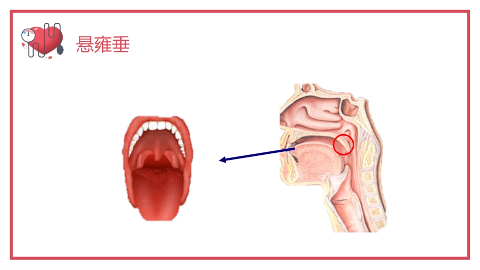 气管内插管术2_第4页