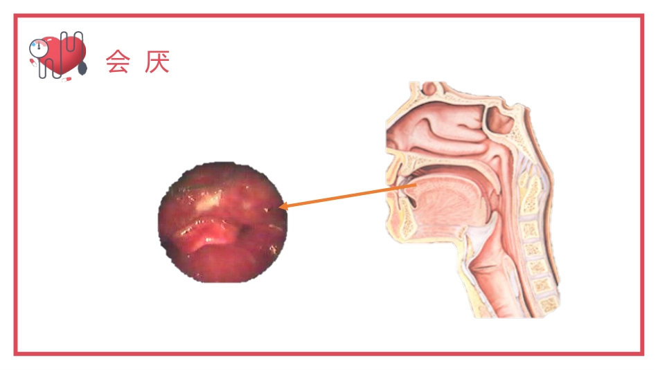 气管内插管术2_第5页
