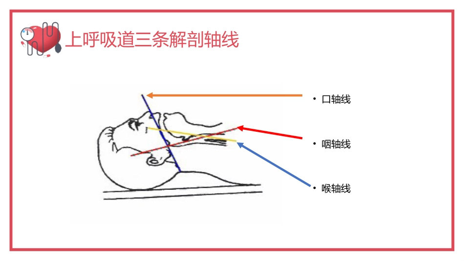 气管内插管术2_第9页