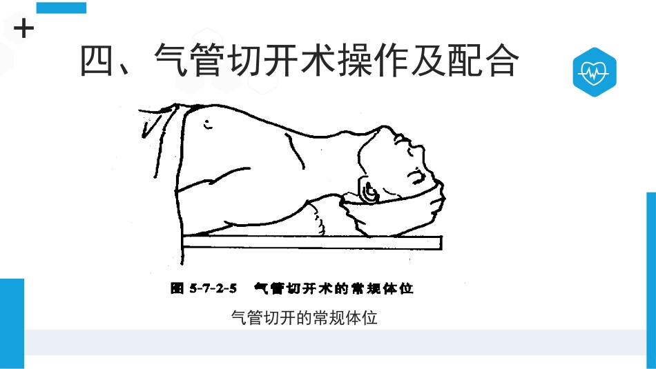 气管切开病人的观察与护理3_第6页