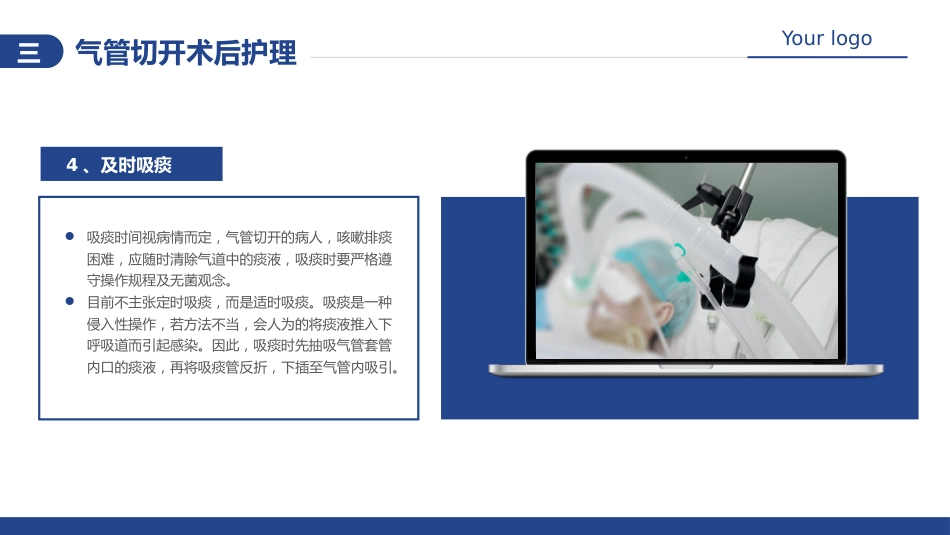 气管切开病人的护理5_第13页