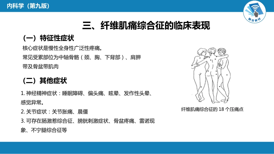 风湿免疫科：纤维肌痛综合征_第6页