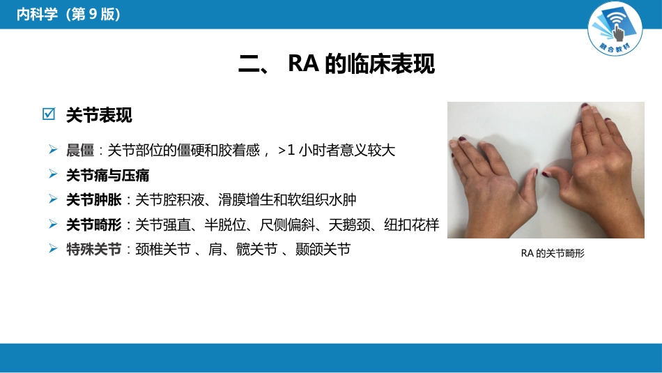 风湿免疫科：类风湿关节炎_第5页