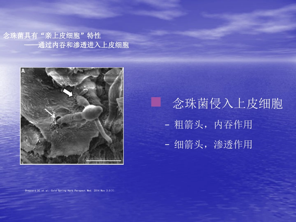 ICU真菌感染特点及治疗策略_第11页