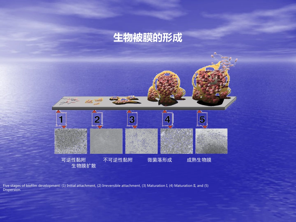 ICU真菌感染特点及治疗策略_第15页