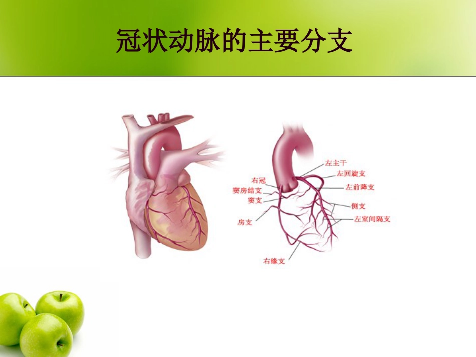 冠状动脉介入治疗及护理_第3页