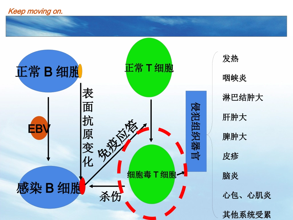 EB病毒感染及传染性单核细胞增多症_第14页