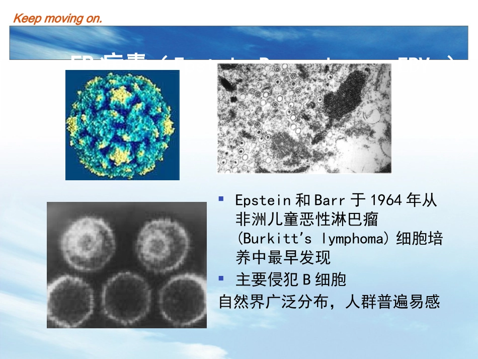 EB病毒感染及传染性单核细胞增多症_第3页