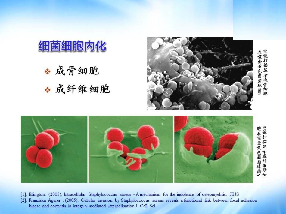 Masquelet技术治疗感染性大段骨缺损_第11页