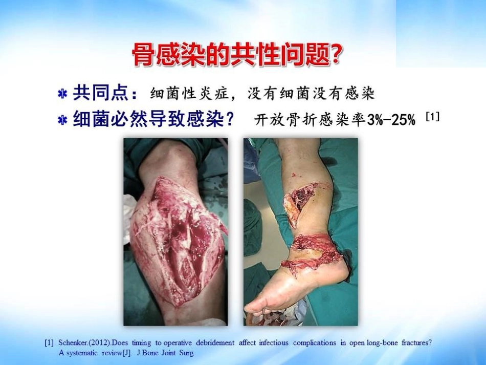 Masquelet技术治疗感染性大段骨缺损_第3页