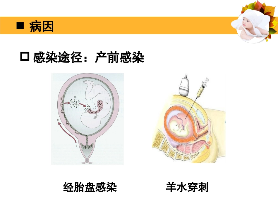 2019上8新生儿败血症_第7页