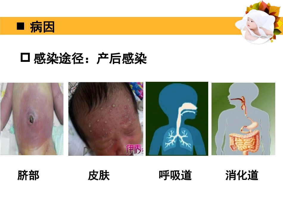 2019上8新生儿败血症_第9页