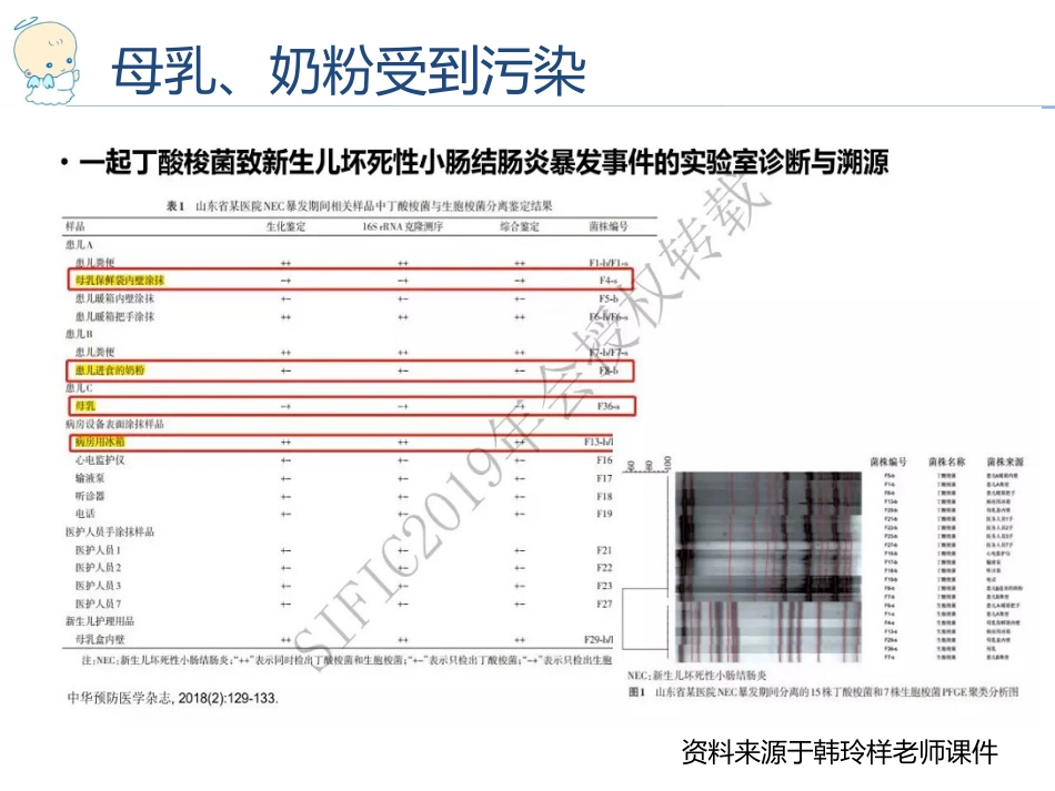 201979新生儿医院感染预防与控制_第13页