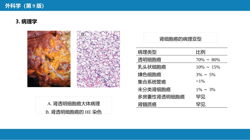 泌尿、男生殖系统肿瘤 第一、二节_第6页