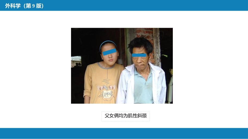 运动系统畸形_第10页