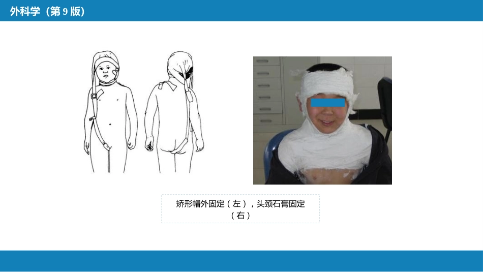 运动系统畸形_第14页