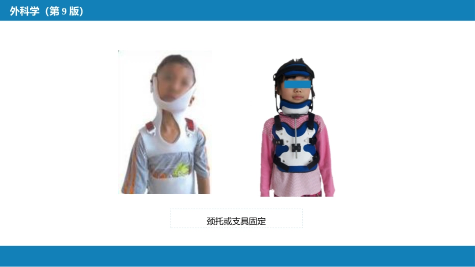 运动系统畸形_第15页