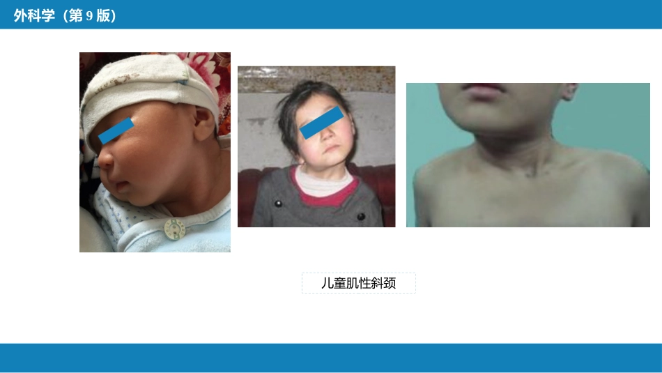 运动系统畸形_第7页