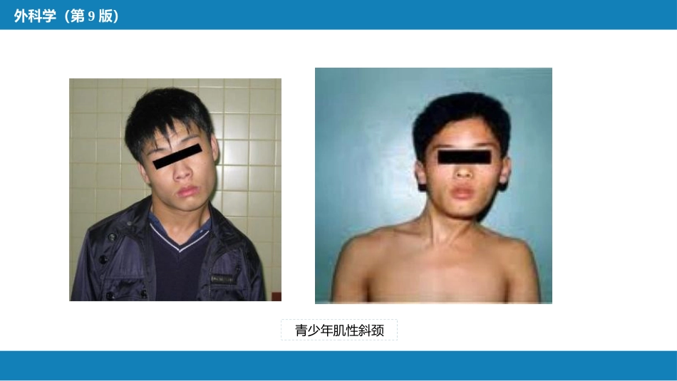 运动系统畸形_第8页
