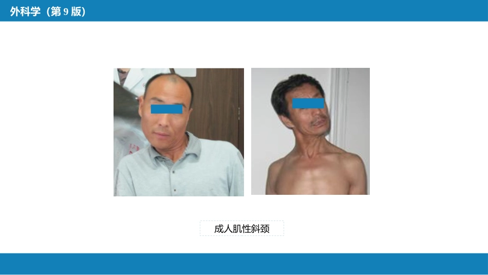 运动系统畸形_第9页
