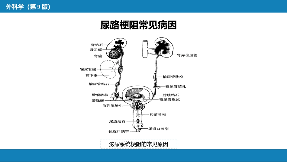 尿路梗阻_第12页