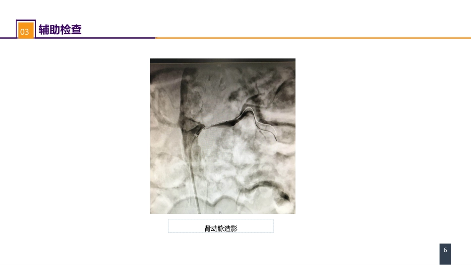 案例分析-肾血管性高血压_第6页