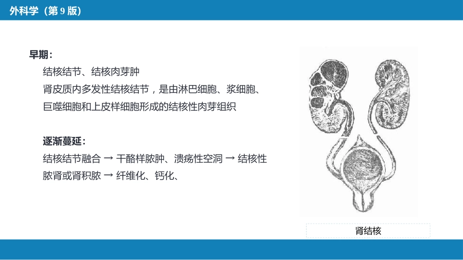 泌尿、男生殖系统结核_第8页