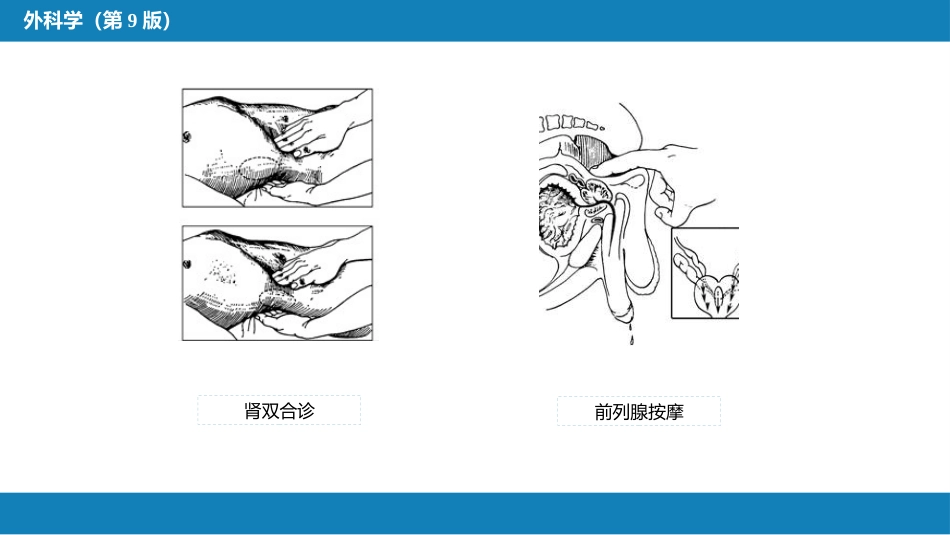 泌尿、男生殖系统外科检查和诊断_第14页