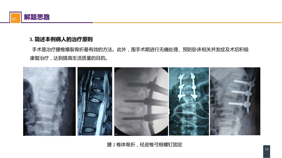 案例分析-腰椎爆裂骨折_第10页