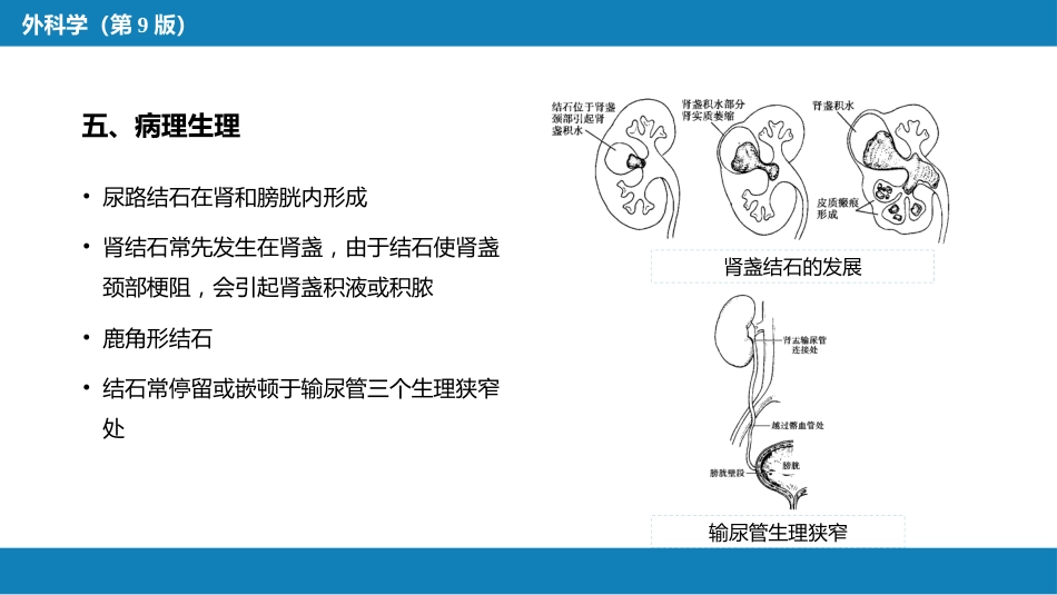 尿路结石_第9页