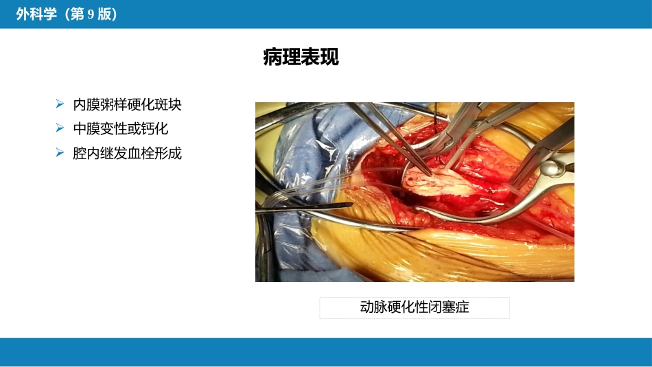 周围血管与淋巴管疾病_第13页