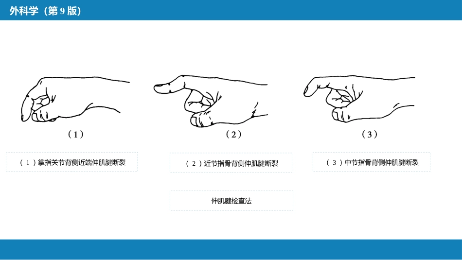 手外伤及断肢（指）再植_第8页
