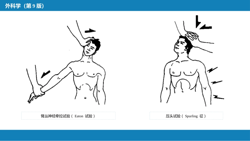颈、腰椎退行性疾病 第一节 颈椎退行性疾病_第7页