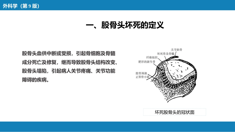 股骨头坏死_第4页