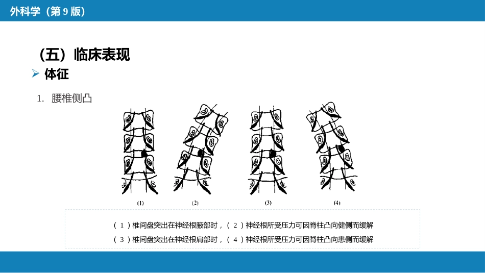 颈、腰椎退行性疾病 第二节 腰椎退行性疾病_第10页