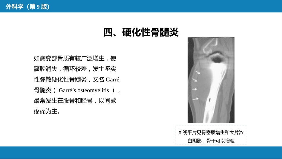 骨与关节化脓性感染_第15页