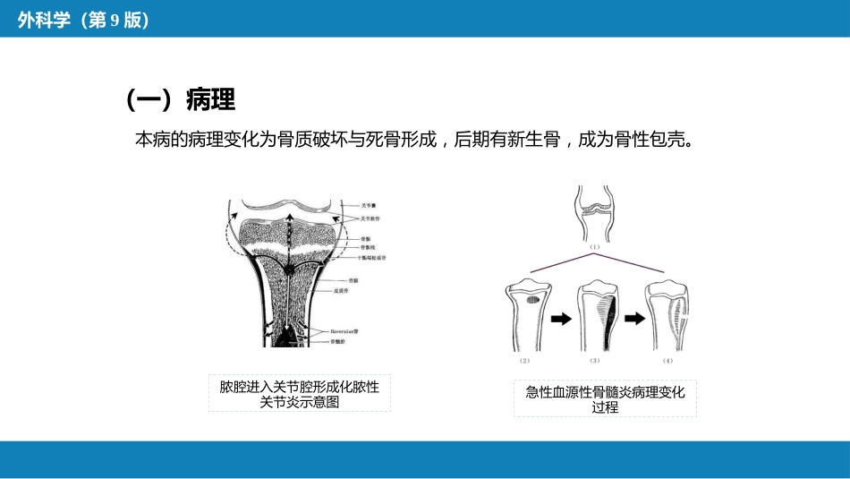 骨与关节化脓性感染_第6页